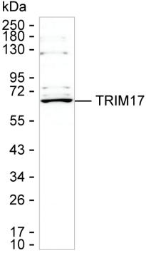 TRIM17